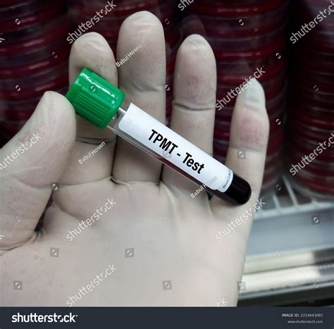 Blood Sample Thiopurine Methyltransferasetpmt Test Thiopurine Stock Photo 2214643065 | Shutterstock