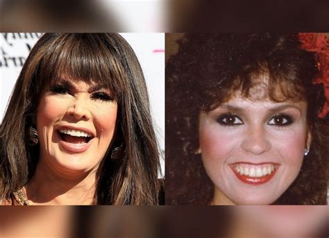 Marie Osmond Plastic Surgery: Actress Has Admitted Rumors About Plastic ...