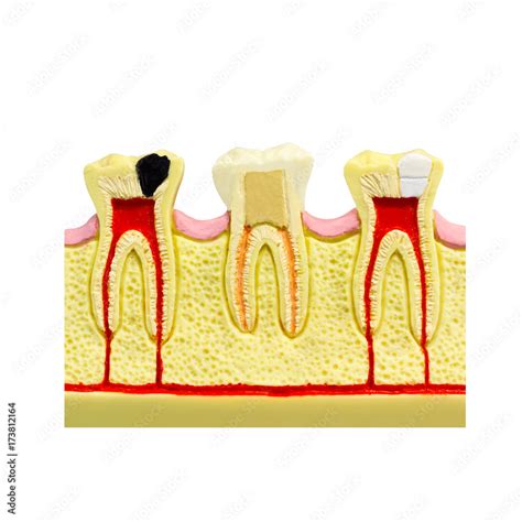 Human tooth gum cross section Tooth Root canal Tooth Detailed anatomy tooth color image ...