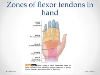 Flexor tendon injuries | PPT