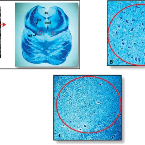 Schematic representation of the localization of the raphe nuclei in the ...