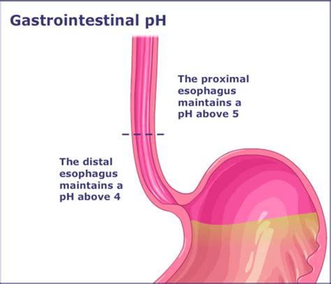 Gastric Acid Ph