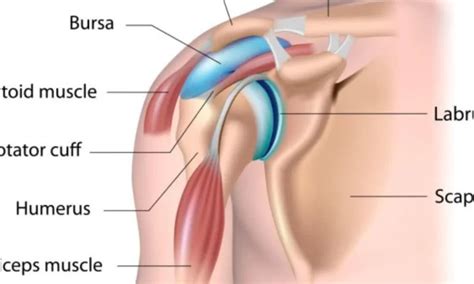 Subacromial bursitis physical therapy Archives - Mobile Physiotherapy Clinic