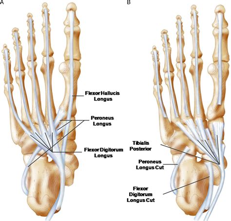 Intrinsic Foot Muscles