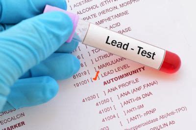 Lead Contamination Testing You Can Depend On