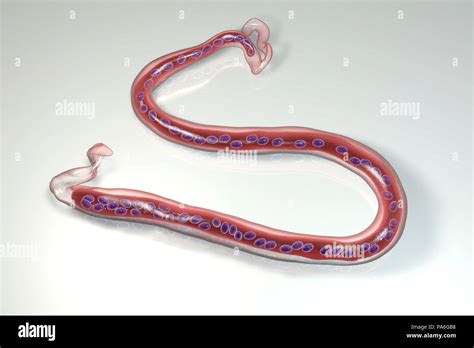 Loa loa worm hi-res stock photography and images - Alamy