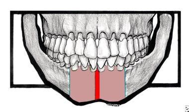 Symphysis Mandibular