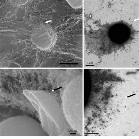 Conventional SEM images of Synechocystis sp. PCC 6803 prepared by ...