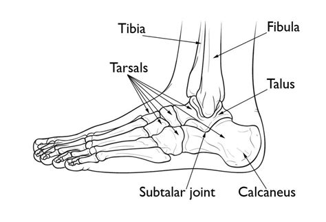 Calcaneus (Heel Bone) Fractures - OrthoInfo - AAOS