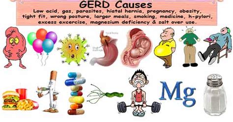 GERD Causes | Gastrodigestivesystem