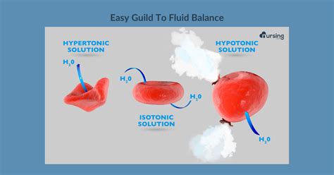 Hypertonic Hypotonic Isotonic Iv Solutions