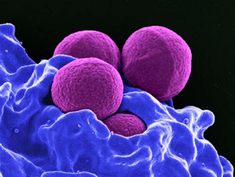 Investigators May Unlock Mystery of How Staph Cells Dodge Immune System ...