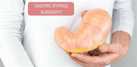 I am advised to have a gastric bypass surgery. Please help.