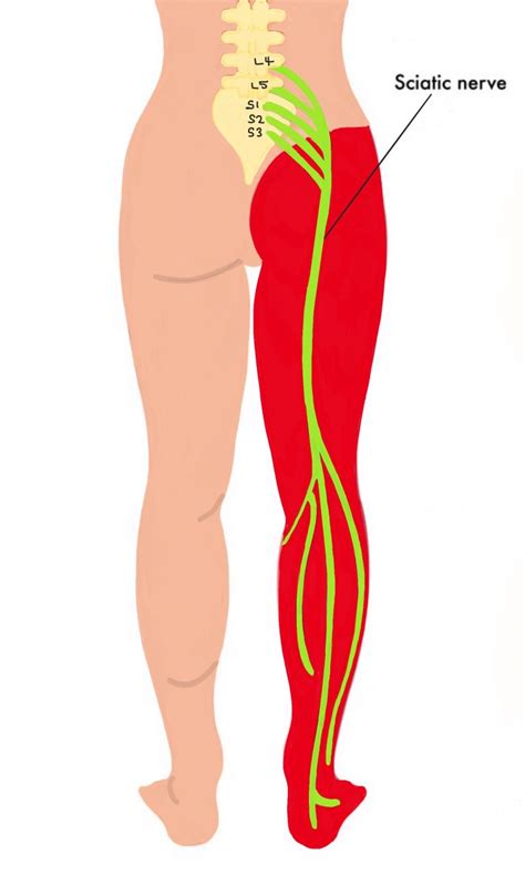 Sciatic nerve dermatome - The Iveson Clinic for Physiotherapy and Chiropractic