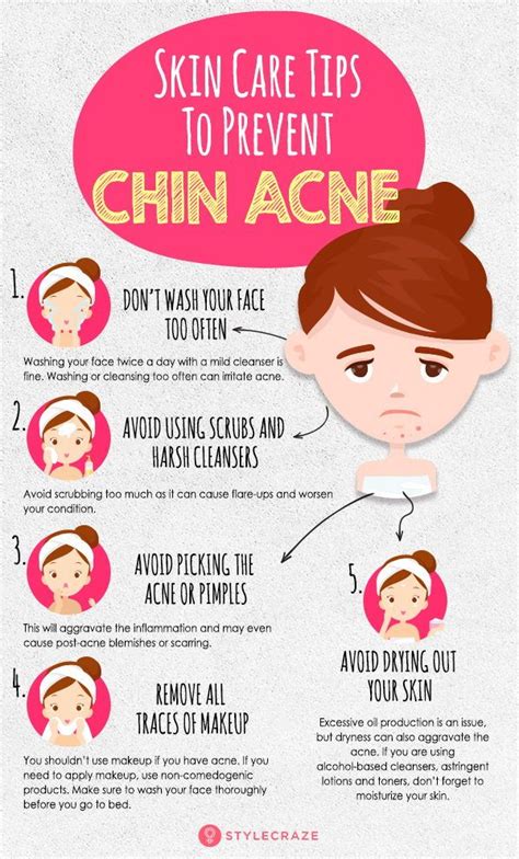 Chin Acne & Pimples: Causes, Treatment, And Skin Care Tips | Chin acne ...