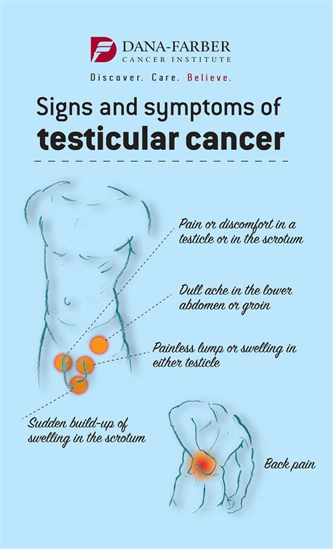 Treatment of Testicular Cancer in Young Men. Signs and Symptoms of testicular cancer ...