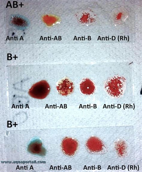 Hémagglutination : définition et explications