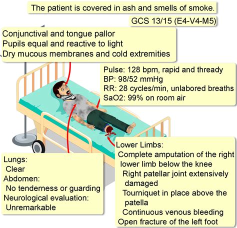 Blast Injury - Interactive case study | Clinical Odyssey by Medical ...