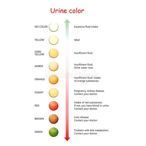 Urine Stock Illustrations – 11,726 Urine Stock Illustrations, Vectors & Clipart - Dreamstime