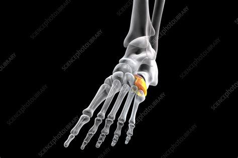 Cuboid bone, illustration - Stock Image - F036/6555 - Science Photo Library