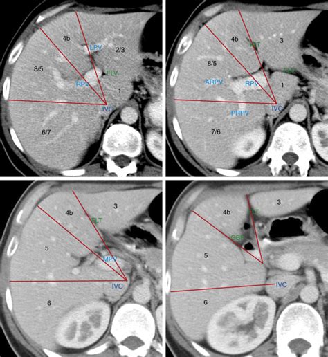 Liver | Radiology Key