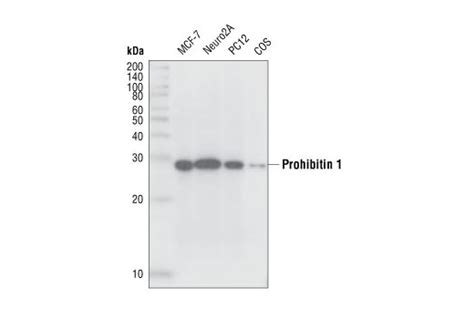 Mitochondrial Marker Antibody Sampler Kit | Cell Signaling Technology