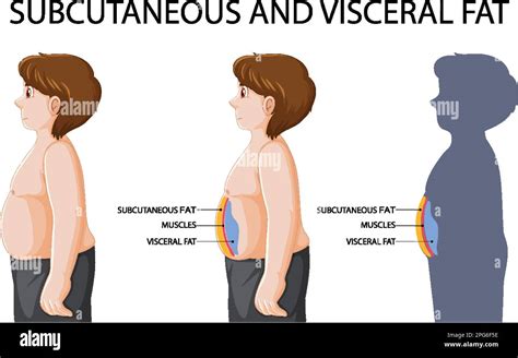 Subcutaneous and visceral fat diagram illustration Stock Vector Image ...