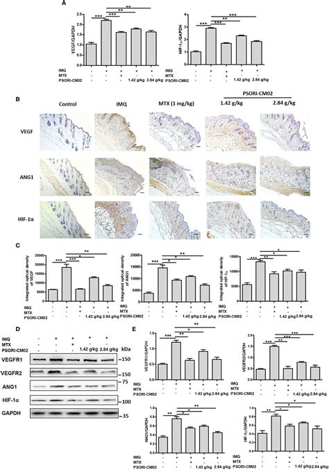 Frontiers | Anti-Angiogenic Efficacy of PSORI-CM02 and the Associated ...