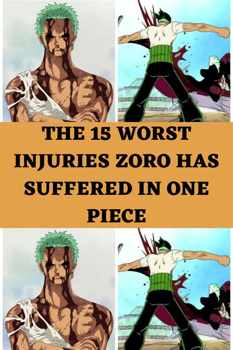 The 15 worst injuries zoro has suffered in one piece – Artofit