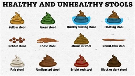 Can you tell the healthy poos from the unhealthy ones? | The US Sun