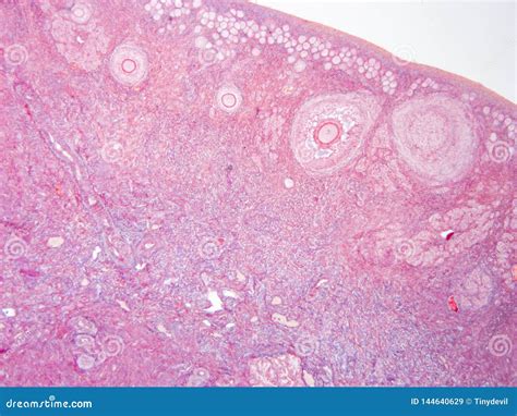 Histology of Ovary Human Tissue Stock Image - Image of microscopy, cuboidal: 144640629