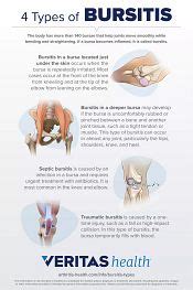 What Is Bursitis?