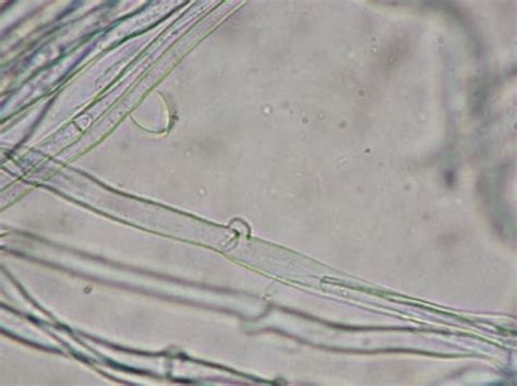 What is Mycelium? – Microscope Clarity