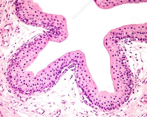 Ureter mucosa, light micrograph - Stock Image - C047/7744 - Science Photo Library