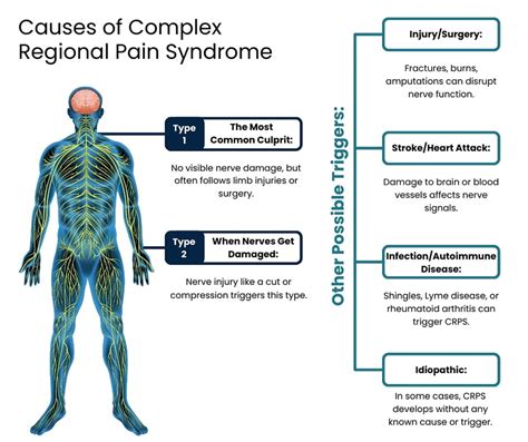 Complex Regional Pain Syndrome (CRPS) Treatment NYC