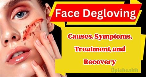 Degloved Face: Causes, Symptoms, Effective Treatment Options, and Recovery - 3plehealth Blog