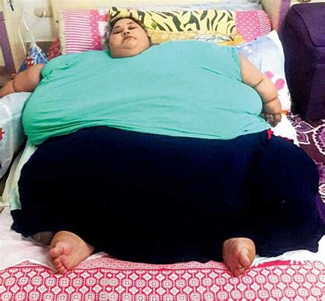 Worlds Heaviest Woman Eman Ahmed Loses Over 100 kg In 3 Weeks Through Diet And Physiotherapy