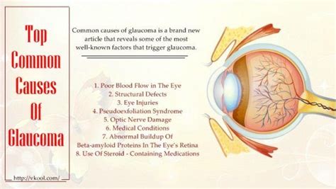 Top 8 Common Causes Of Glaucoma