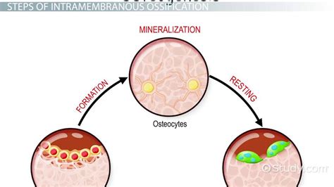 Intramembranous Ossification | Definition, Steps & Formation - Video & Lesson Transcript | Study.com