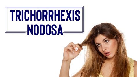 Trichorrhexis Nodosa - Causes And Treatment | Hair Loss Problem - YouTube