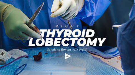 Right Thyroid Lobectomy by Sanziana A. Roman, MD, FACS - YouTube