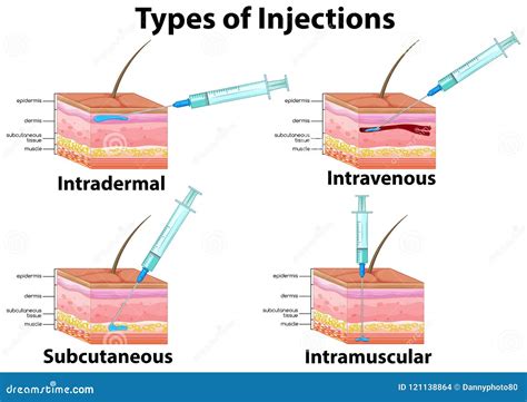 Intradermal And Subcutaneous Injection Vector Illustration | CartoonDealer.com #79997650