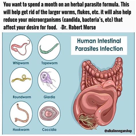 #Repost @domingoslop3s Parasites are organisms that live in and feed ...