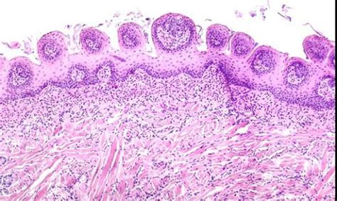 Fungiform Papillae of the Tongue – Collection of Histology Images