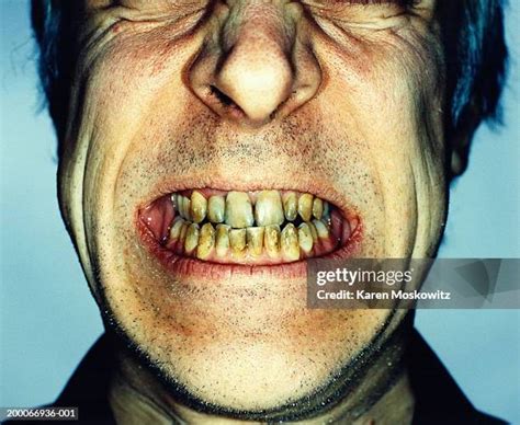 1,052 Ugly Teeth Stock Photos, High-Res Pictures, and Images - Getty Images