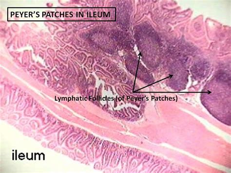 Peyer's Patch Slide | Anatomy Physiology | Flickr