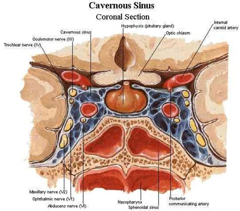 Cavernous Sinus | Sinusitis, Oral health care, Dental health