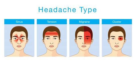 Sinus Headache vs Migraine | Virtual Doctor Appointments