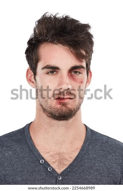 Portrait Injury Man Black Eye Studio Stock Photo 2254668989 | Shutterstock