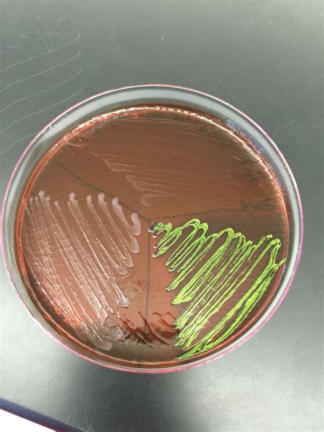 EMB AGAR PLATE | Microbiology, Bacteria, Agar